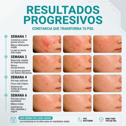 DERMA PRO™ Solución Secante Avanzada Para Granos Acné